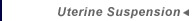 Uterine Suspension