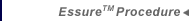 Essure Procedure